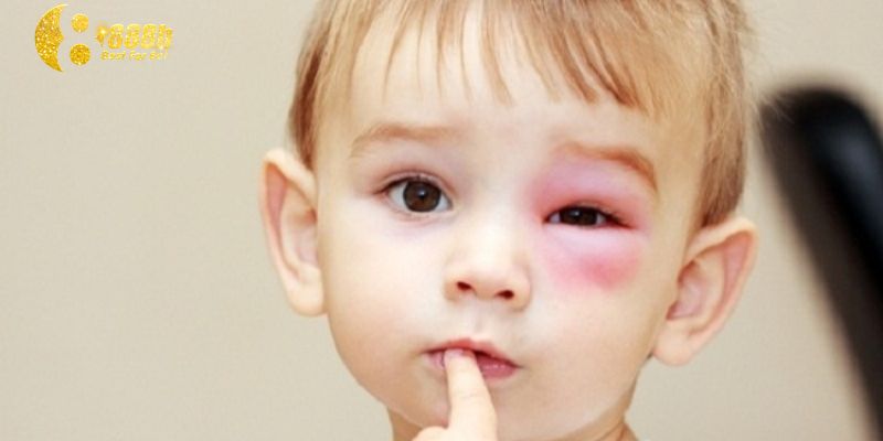 Giải mã giấc mơ bị ong đốt chính bản thân tiết lộ điềm báo bất ngờ